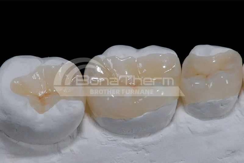 sinter-dental