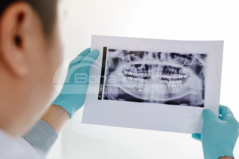 dentist-analyzed-the-teeth-of-patients